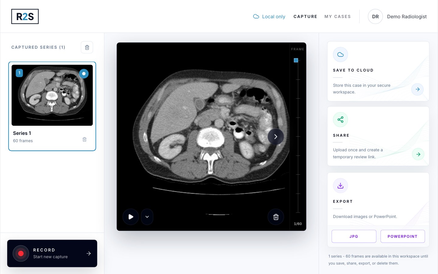 The captured series of 60 frames in the review screen, with play, delete and a frame slider.